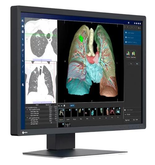 24’’ Eizo RadiForce MX243W-BK (IPS LED, 1920x1200, 320, 6ms, 60Hz) (DP, DVI, 2xUSB 2.0) czarny