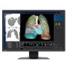 24’’ Eizo RadiForce MX243W-BK (IPS LED, 1920x1200, 320, 6ms, 60Hz) (DP, DVI, 2xUSB 2.0) czarny